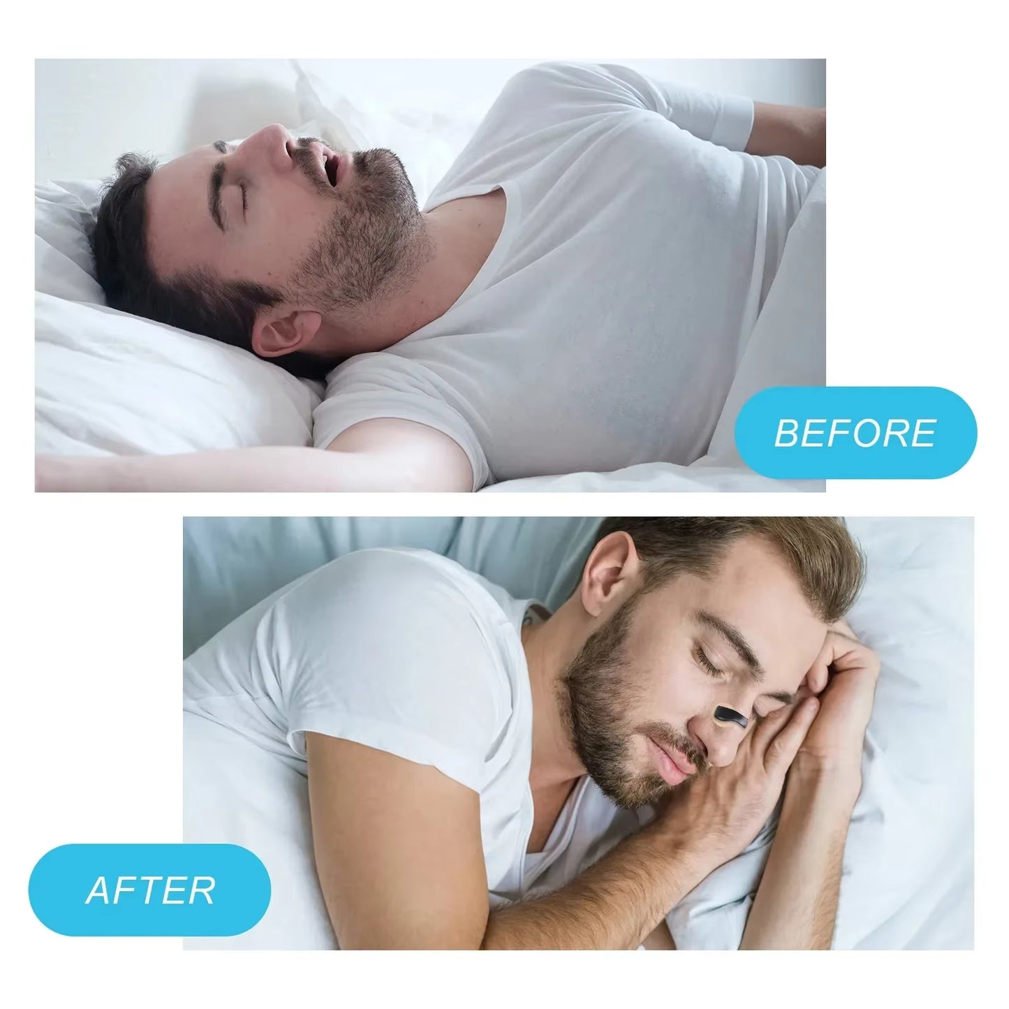 Magnetic Nasal Dilator